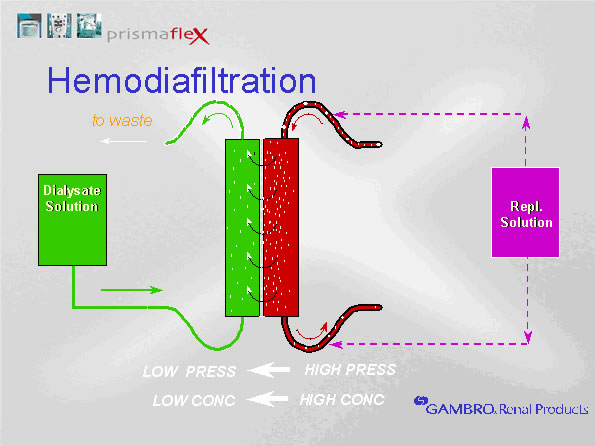 CRRT diagram